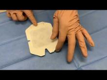Embedded thumbnail for Cambio medicazione di un PICC utilizzando un pack procedurale