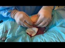 Embedded thumbnail for Impianto di FICC port