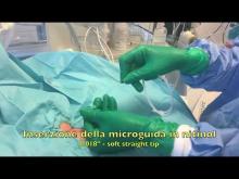 Embedded thumbnail for FICC tunnellizzato 3Fr in neonato