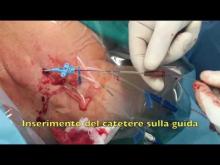 Embedded thumbnail for CICC medicato in paz adulto Arrow Gard Blue Plus